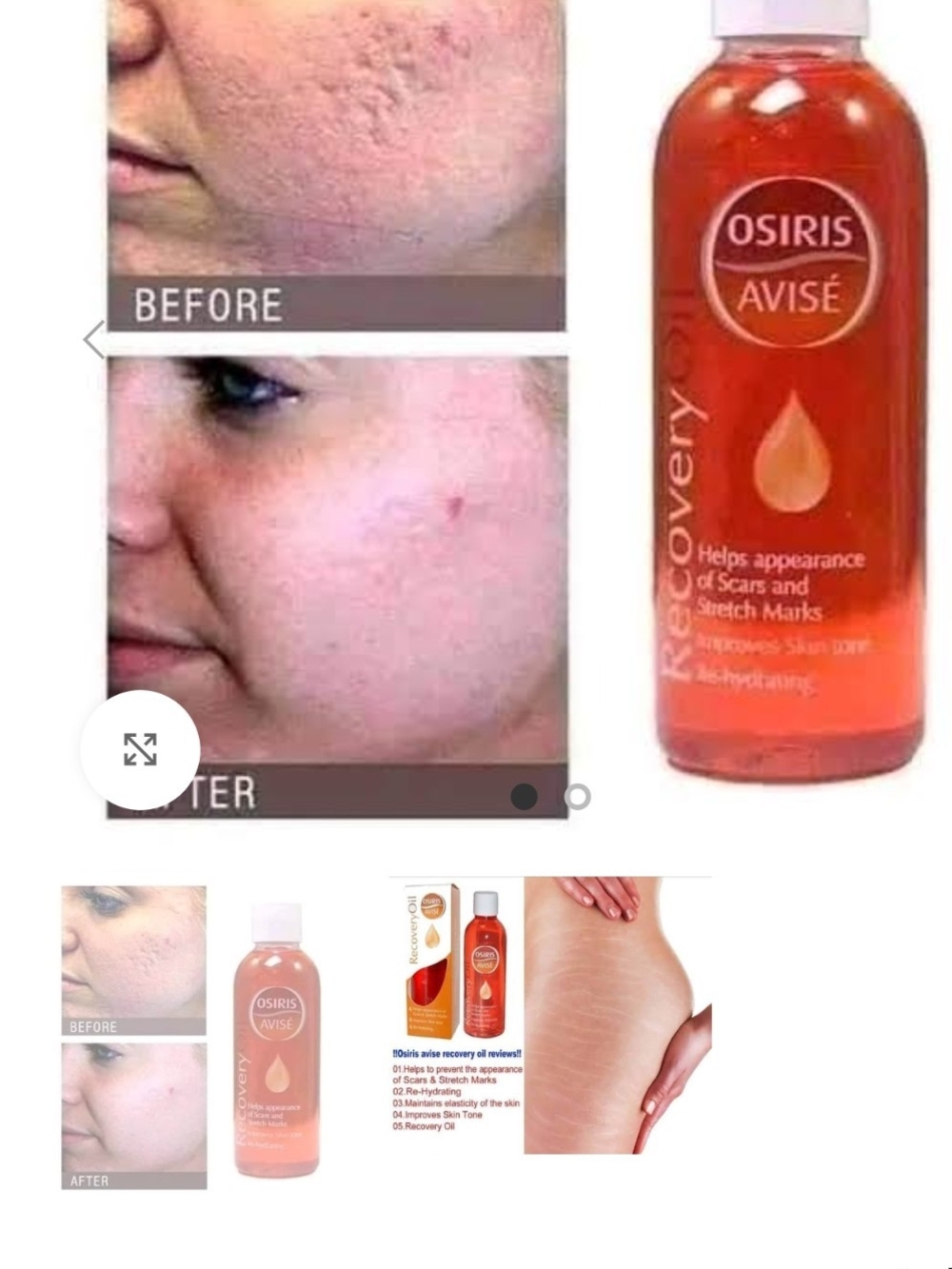 Recovery Oil – Skin Scar & Stretch Mark Care (Orange)